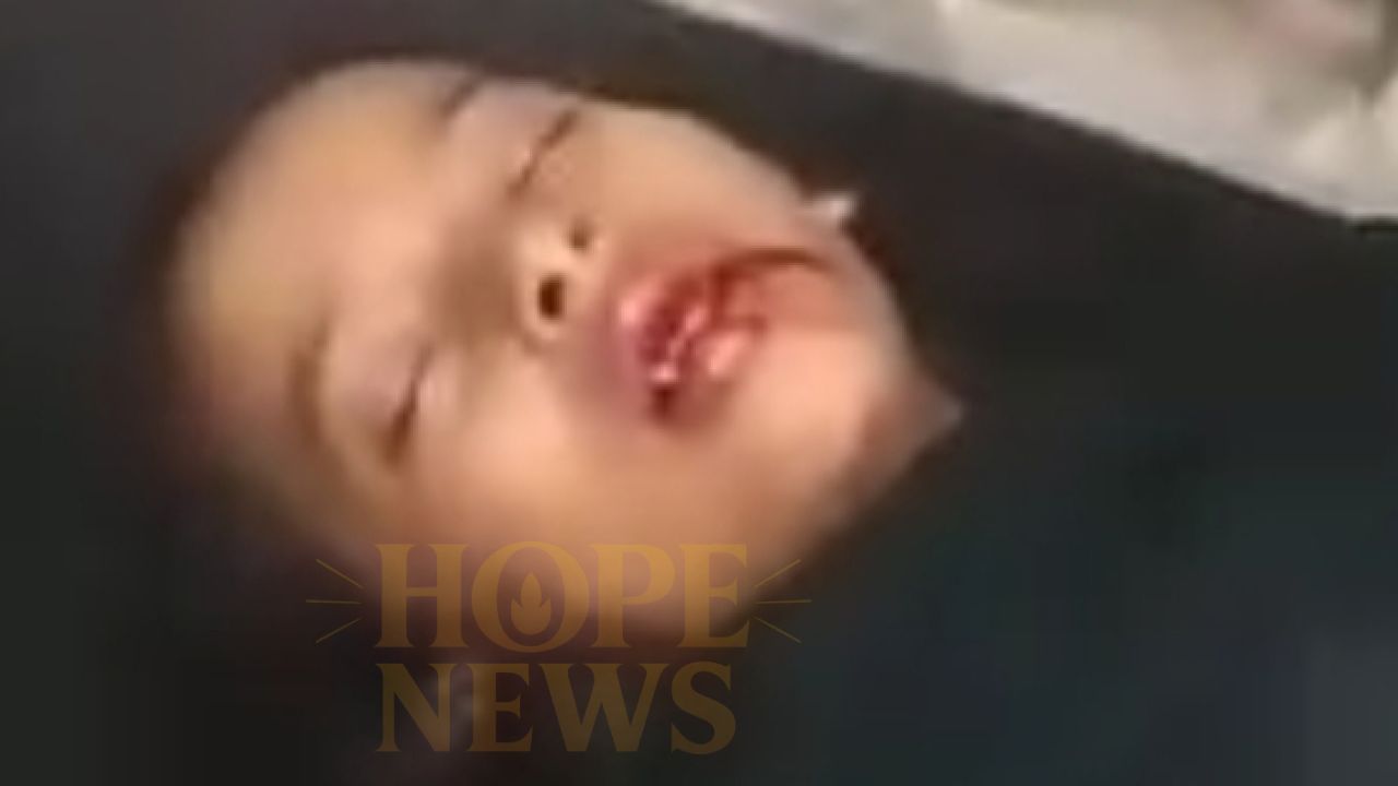 পলাশবাড়ীতে পাওনা টাকা চাওয়ায় কিশোরীকে পিটিয়ে দাত ভাঙল দেনাদার